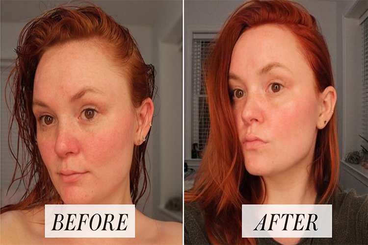 I skipped this part of my skincare routine and it completely transformed my skin