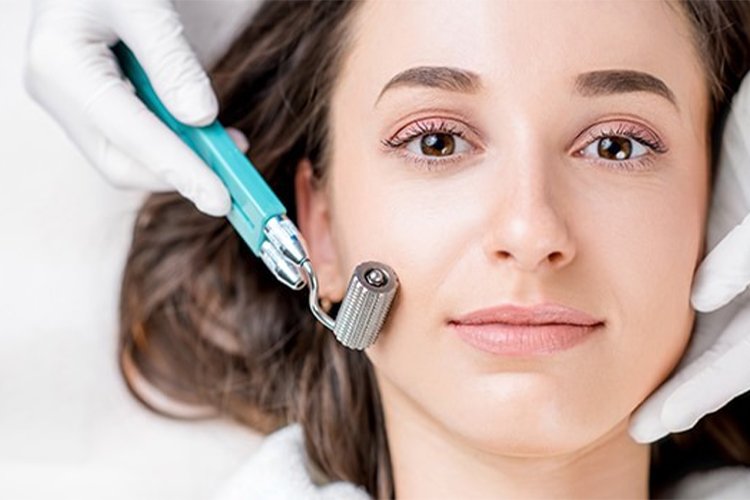 Interested in microneedling? Here's everything you need to know before booking an appointment